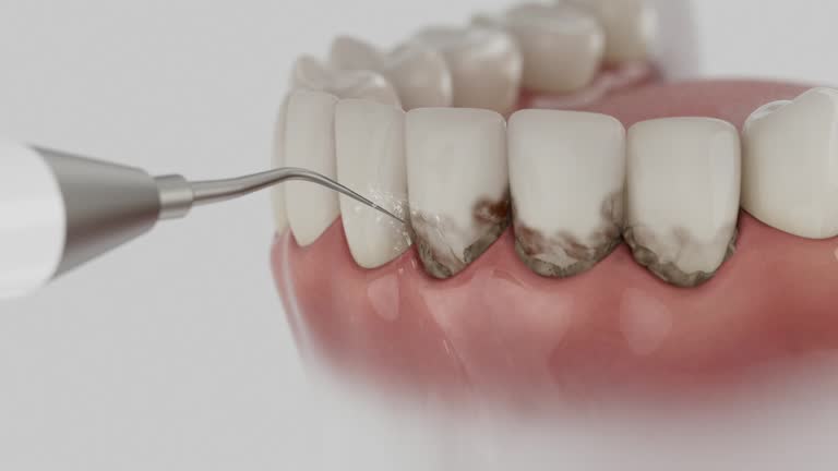 Trusted Teeth Cleaning And Checkup service in Wakefield, VA - Dentist Open Now